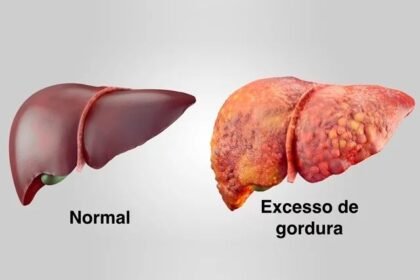 figado